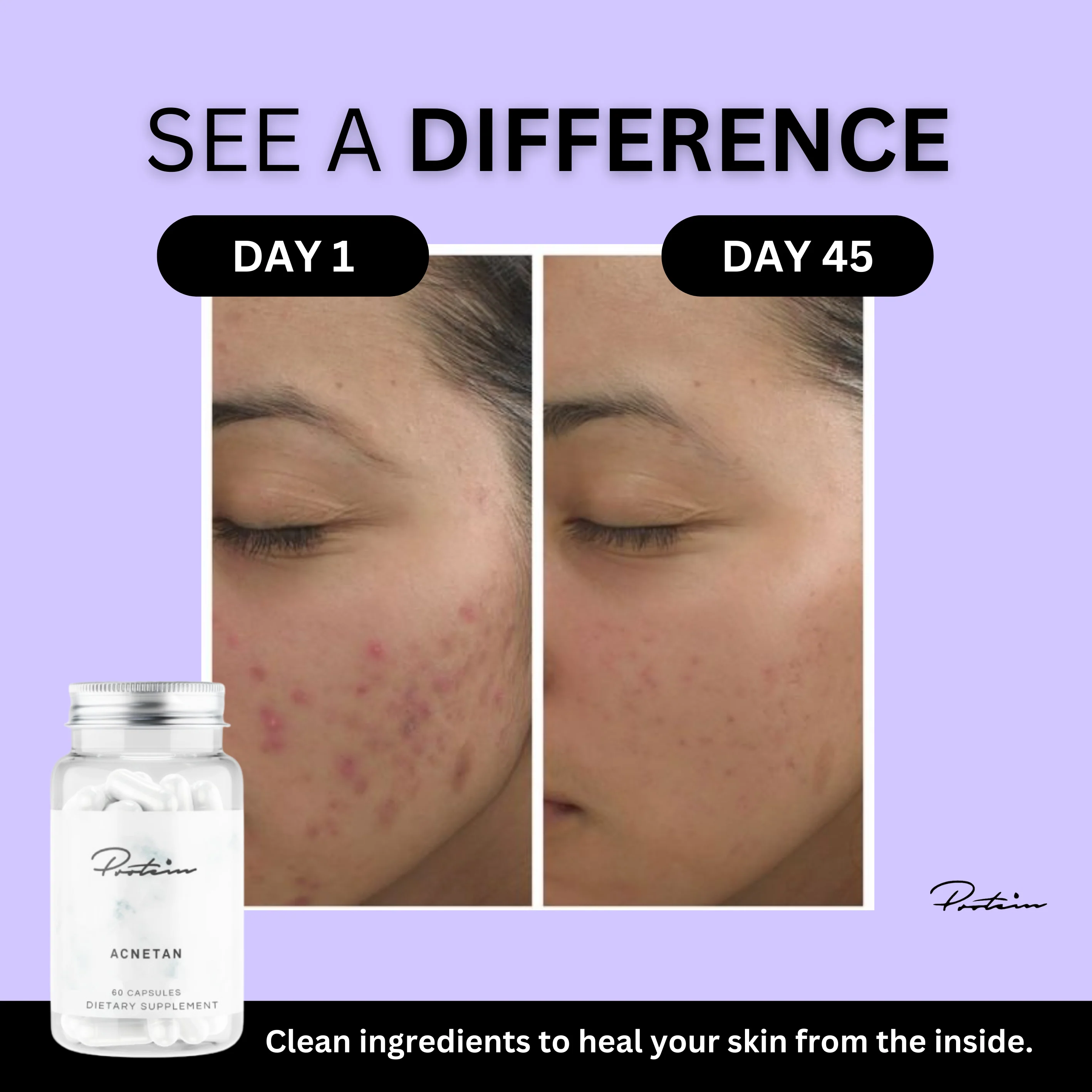 Acnetan | Clear Skin 60 Capsules - Image 8